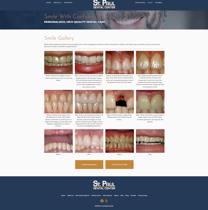 «Галерея улыбок» на сайте St. Paul Dental Center наглядно показывает результаты работы стоматологов